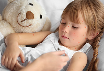 Symptômes et traitement de la varicelle